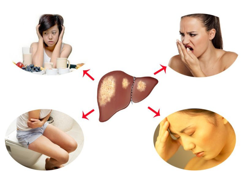 4-bieu-hien-nho-tren-co-the-canh-bao-gan-ngay-cang-yeu-ot-suy-nhuoc