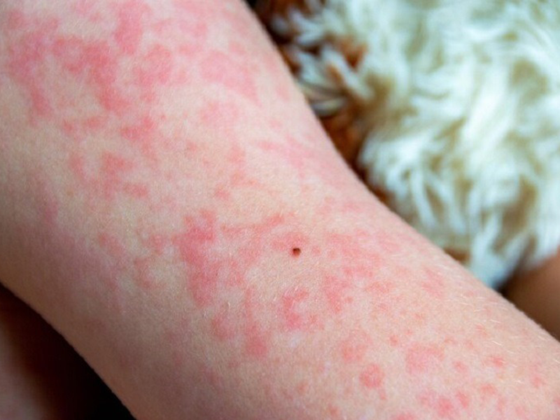 7-thay-doi-tren-da-cang-de-lau-cang-nguy-hiem-den-tinh-mang