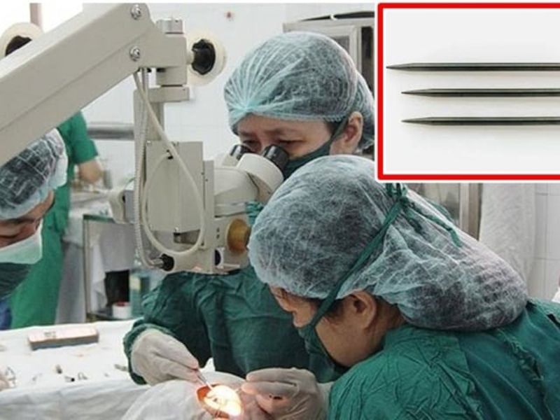 bac-si-hot-hoang-vi-benh-nhan-tu-rut-dinh-cam-sau-trong-mat