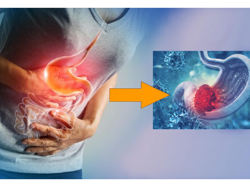 benh-ung-thu-xep-thu-3-o-viet-nam-giet-nhieu-nguoi-the-nao