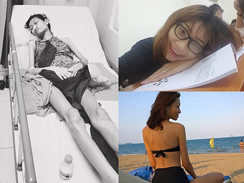 can-benh-ung-thu-nguoi-mau-9x-mac-phai-nguy-hiem-nhung-it-nguoi-de-y