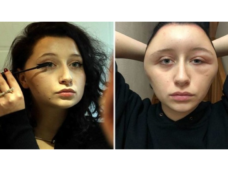 dau-thieu-nu-bat-ngo-to-gan-gap-doi-sau-nhuom-toc-lam-dep