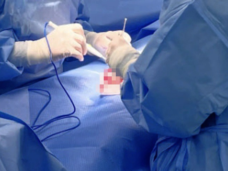 tuong-bi-nhiet-mieng-nguoi-dan-ong-ha-noi-phai-cat-1-goc-ma-vi-ung-thu