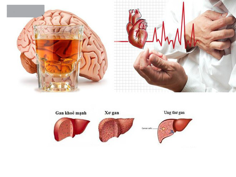 uong-ruou-bia-thuong-xuyen-5-co-quan-noi-tang-boc-hoi-dang-giat-minh