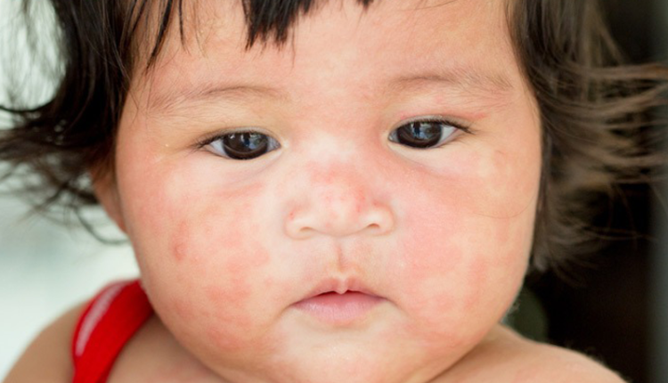 ban-soi-cach-nhan-biet-phong-ngua-va-bao-ve-suc-khoe-trong-giai-doan-bung-phat-hien-nay